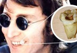 Egy kanadai fogorvos szerezte meg John Lennon egyik fogát